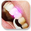 Laser Dentistry